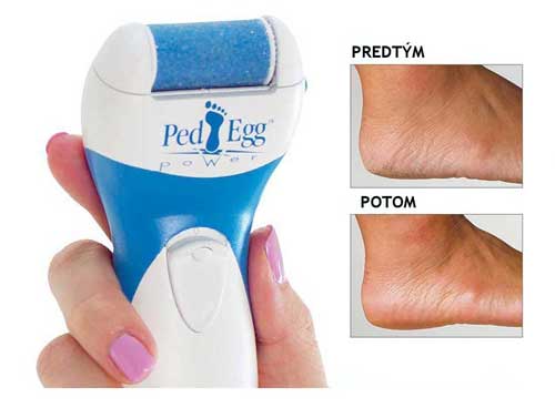 električna domača pedikura ped egg